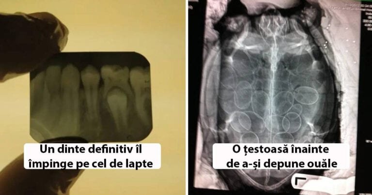 13 imagini incredibile realizate cu raze X care dezvăluie o poveste ascunsă