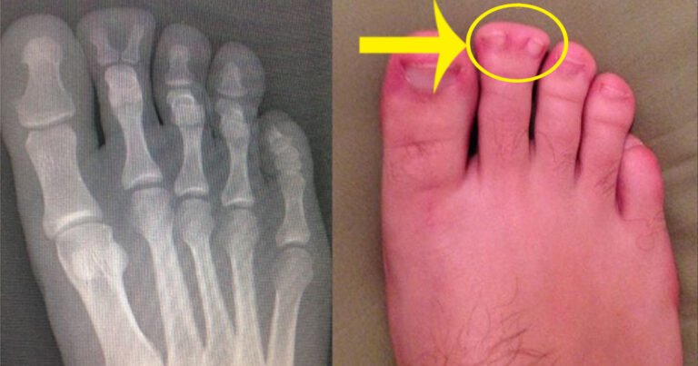 18 dintre cele mai ciudate imagini cu raze X pe care nu le-ai mai văzut până acum