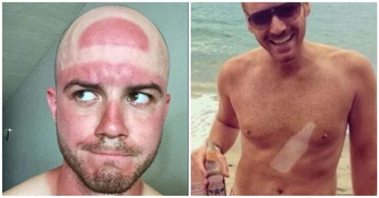 15 Oameni care au uitat că soarele poate crea rapid cele mai amuzante „tatuaje”