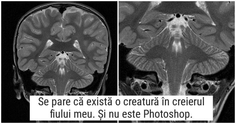 18 lucruri pe care natura nu le poate arăta, dar radiografiile pot