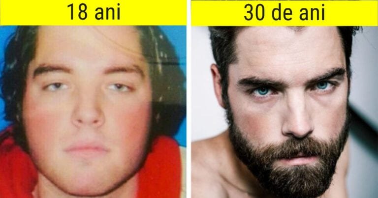 20 de dovezi care demonstreză că timpul este cel mai bun chirurg plastician din lume