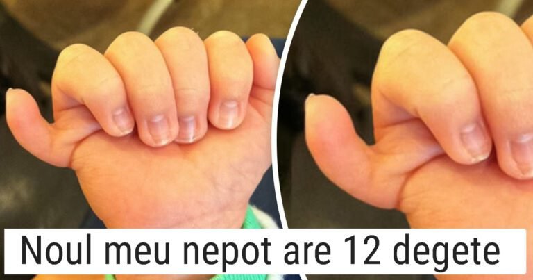 12 Imagini cu oameni care fac lumea mai luminoasă prin unicitatea lor