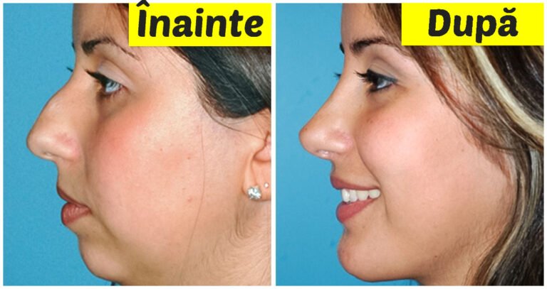 17 situații în care chirurgia plastică i-a ajutat pe oameni să-și sporească încrederea