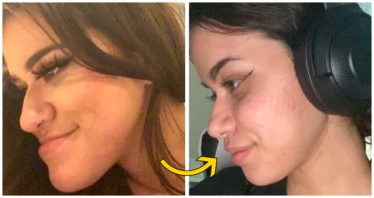 17 oameni care s-au săturat să-și îndure defectele și s-au hotărât să apeleze la chirurgia plastică