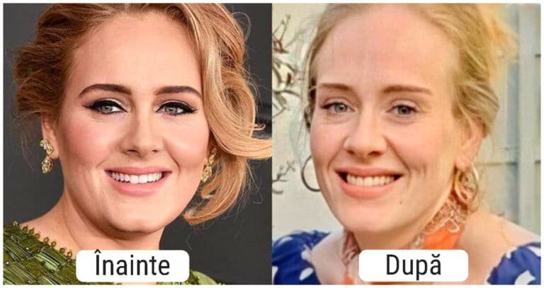 20 de fotografii care arată cum s-au schimbat celebritățile după operație, Photoshop sau din cauza timpului