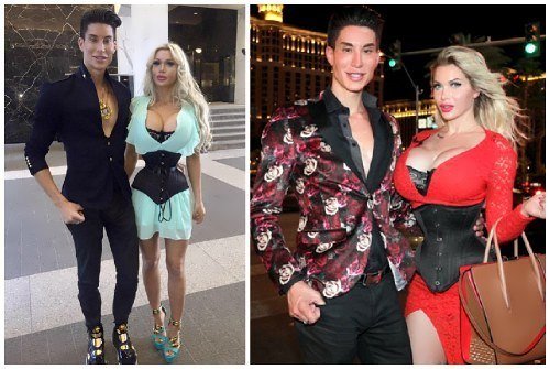 7 imagini cu cele mai neobișnuite cupluri obsedate de chirurgia plastică